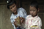 Điện Biên: Em Lò Thị Hằng với căn bệnh tim bẩm sinh xã Xuân Lao huyện Mường Ảng cần được giúp đỡ