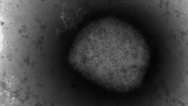 Hình ảnh qua kính hiển vi điện tử của virus đậu mùa khỉ, ngày 26/5. (Ảnh: AP)