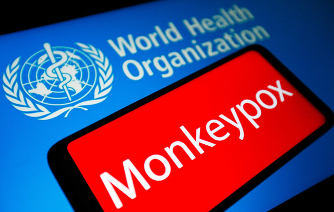 Đến nay các ca mắc đậu mùa khỉ đã được ghi nhận tại hàng chục quốc gia - Ảnh: Getty Images