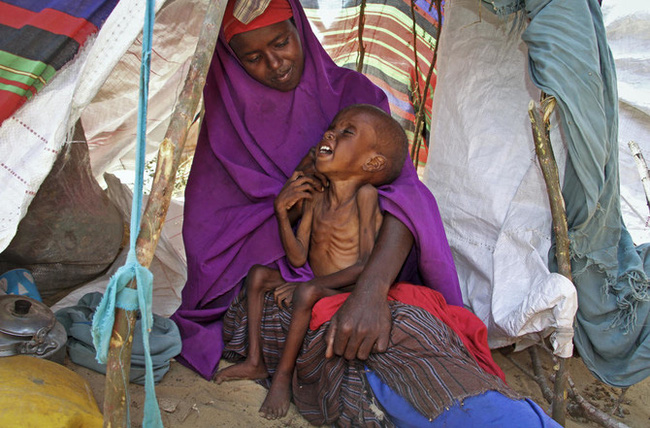 Người dân tại Somalia đang phải đối mặt với nạn đói thảm khốc (Ảnh: AP)