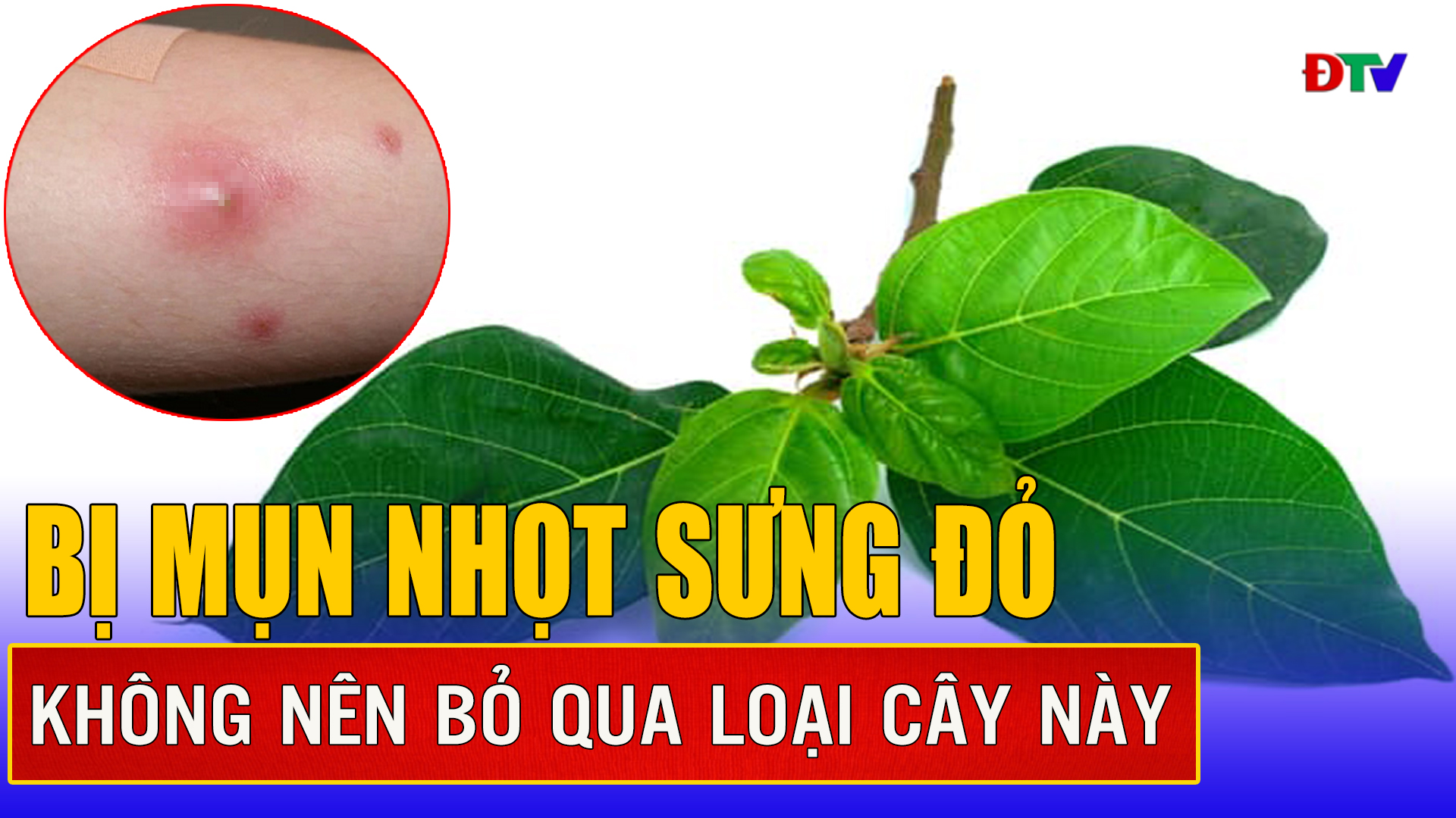 Đánh bay mụn nhọt nhờ loại cây mọc khắp nơi