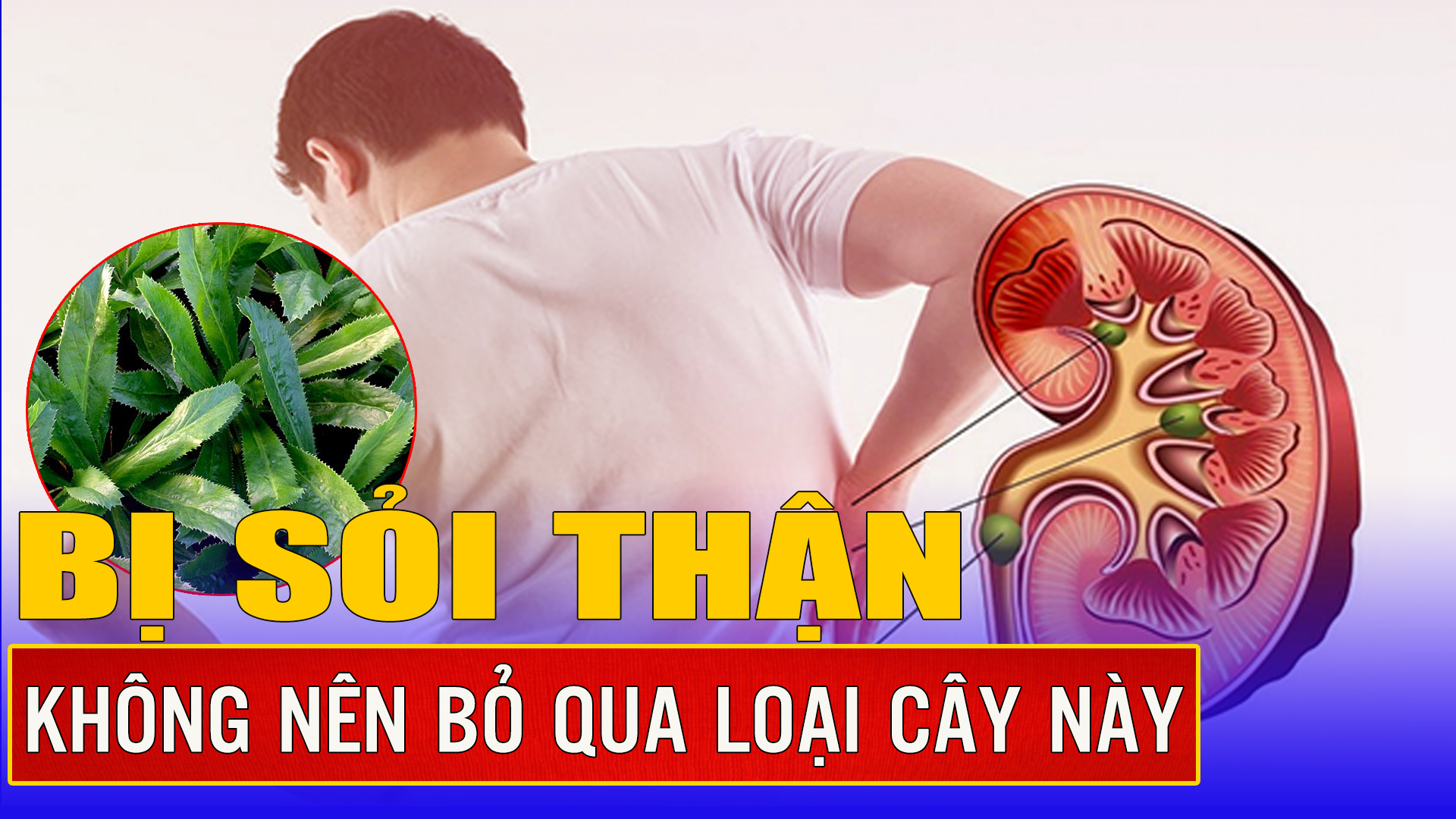 Bị sỏi thận không nên bỏ qua loại cây này