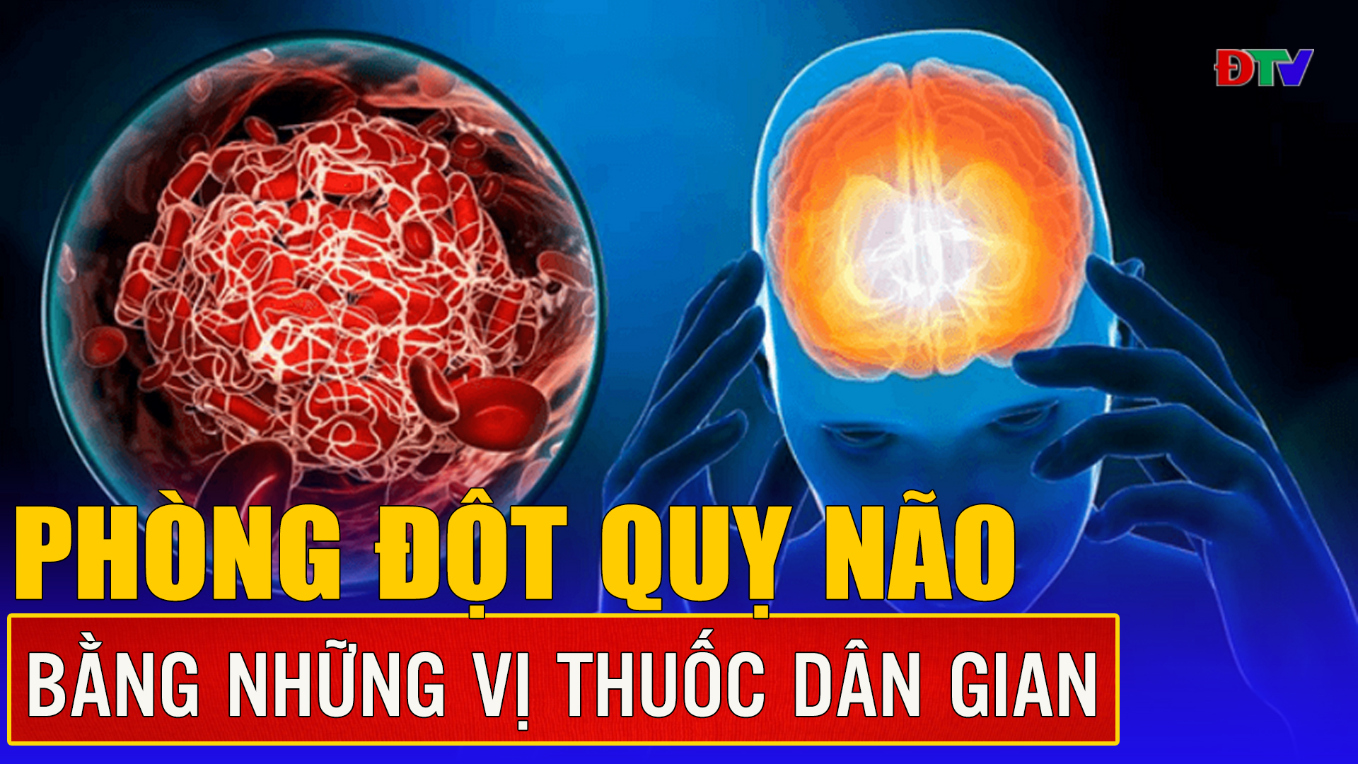 Phòng đột quỵ não bằng  những vị thuốc dân gian